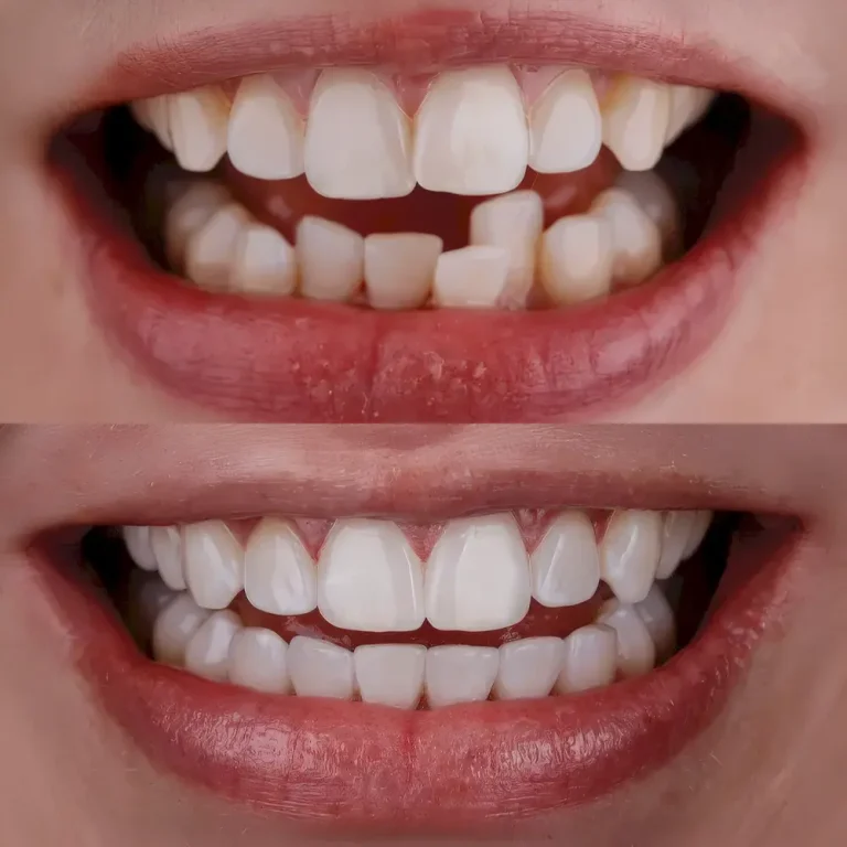 До и после лечения