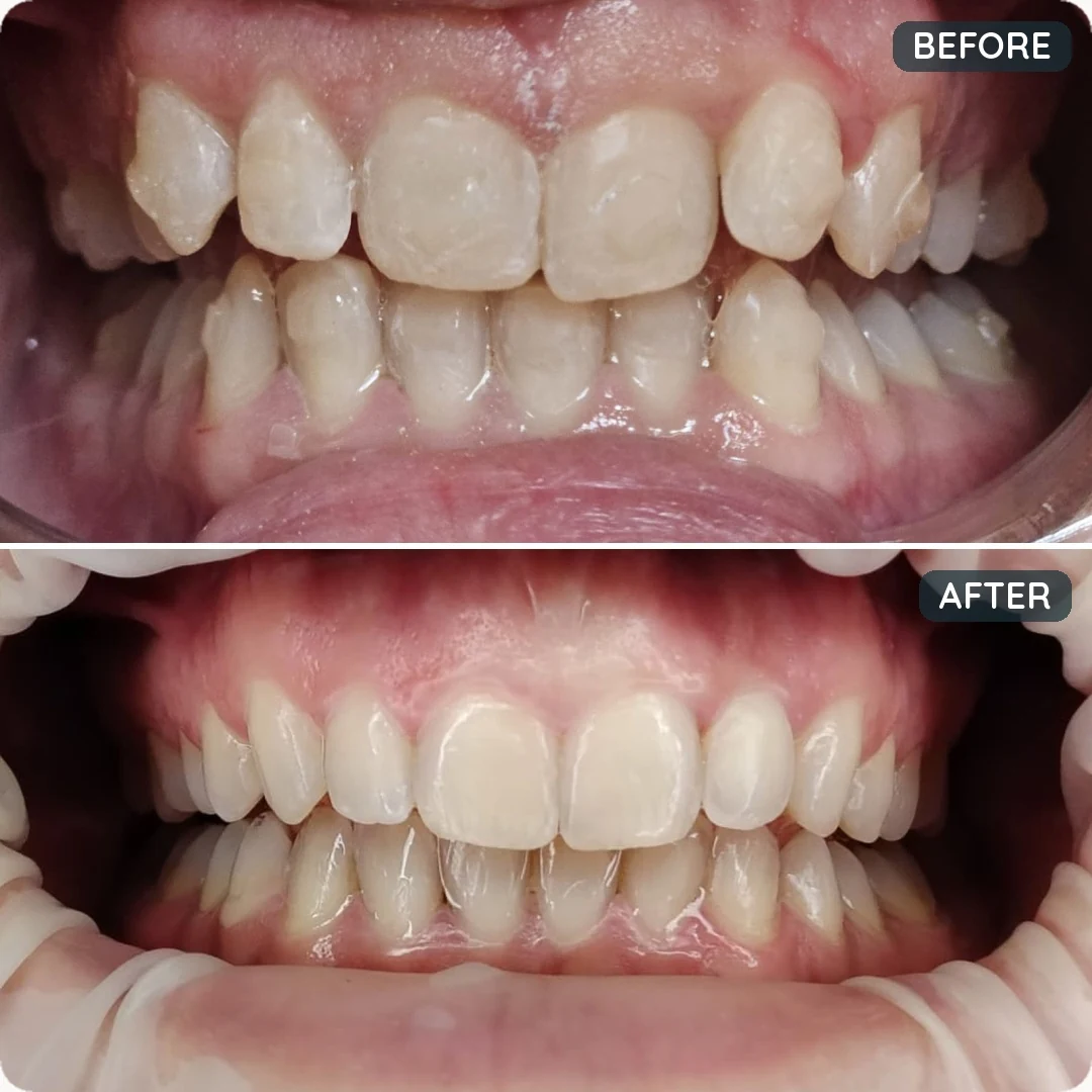 Before and after treatment — patient 3