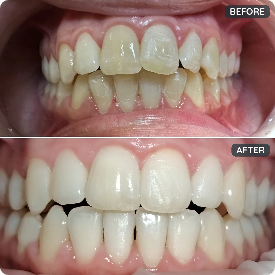 Before and after treatment — patient 5