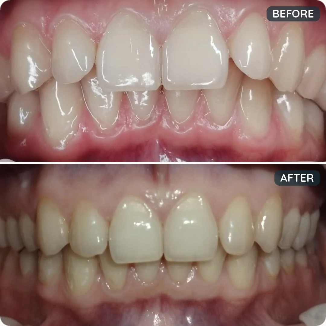 Before and after treatment — patient 7