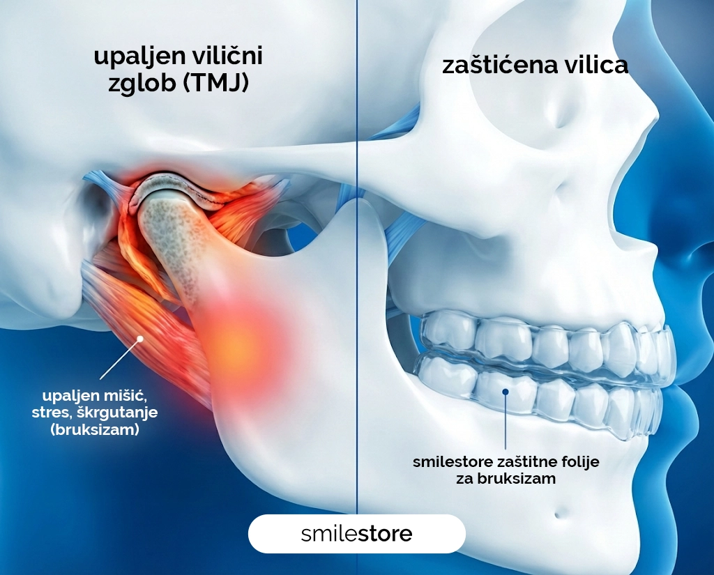 A Comprehensive Guide to Bruxism